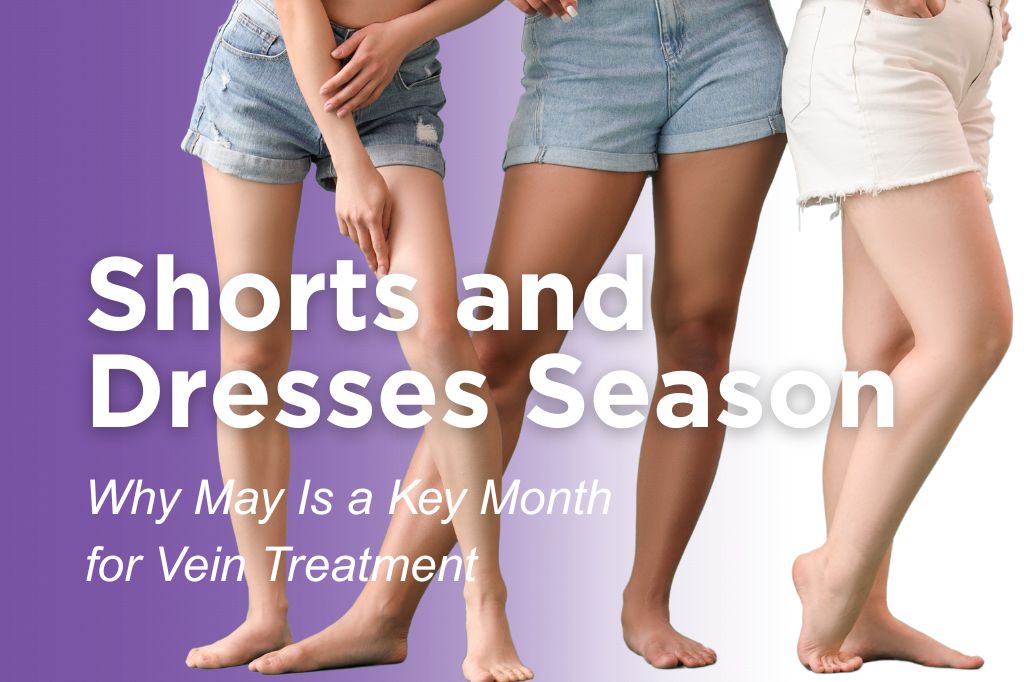 Women wearing shorts with the words 'Shorts and Dresses Season - Why May Is a Key Month For Vein Treatment.'