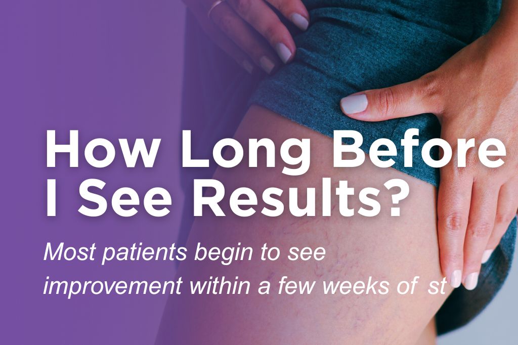 Woman pointing to her leg veins, answering how long after vein treatment patients see results.